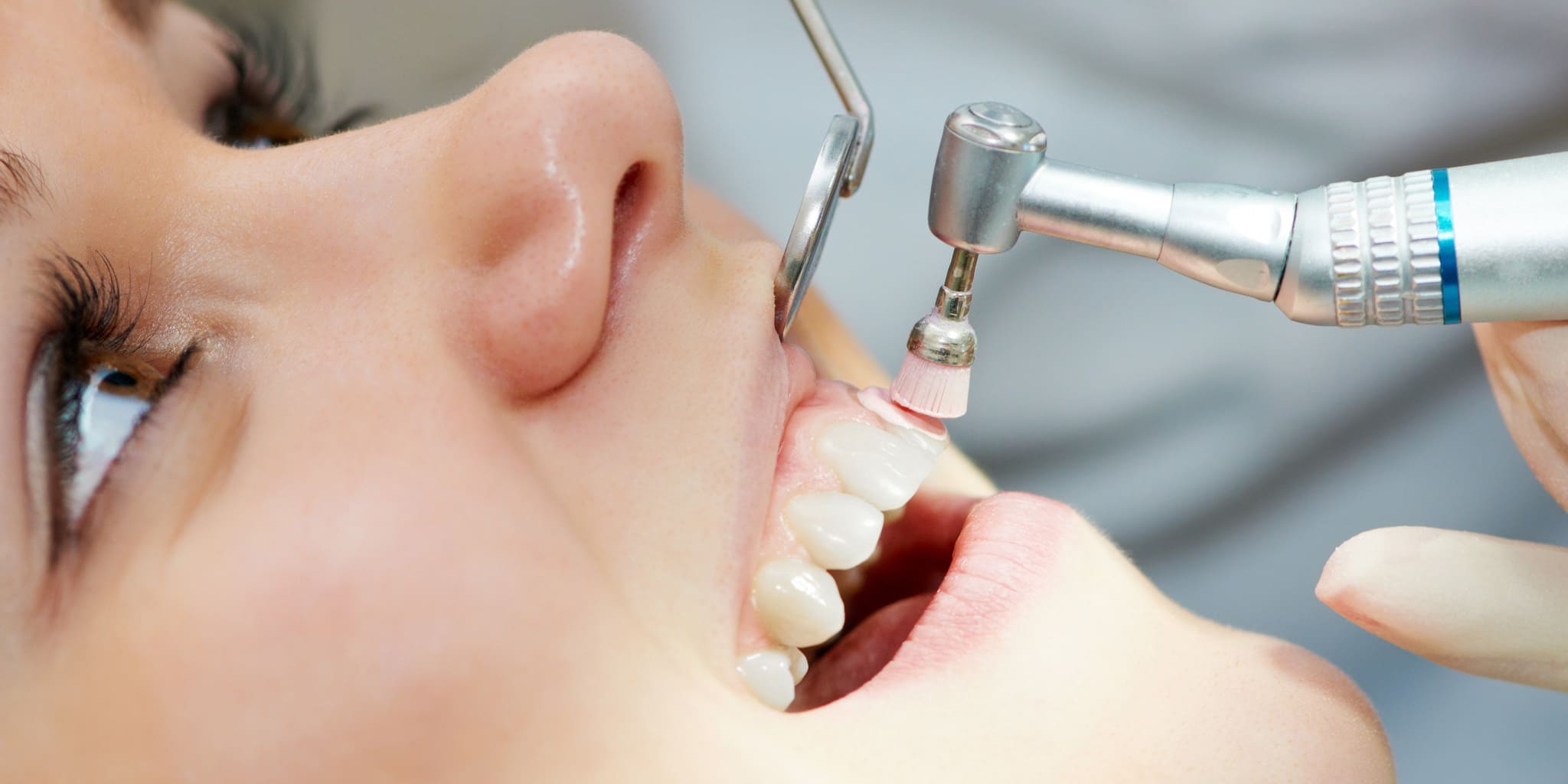 Профессиональная гигиена полости рта что это. Профессиональная гигиена полости рта что это. Снятие зубного налета методом air flow. Профессиональная гигиена. Профессиональная гигиена.