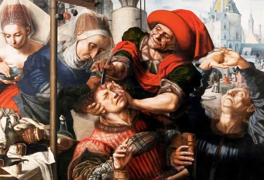 Трэпанацыя.1550-1555 гг.